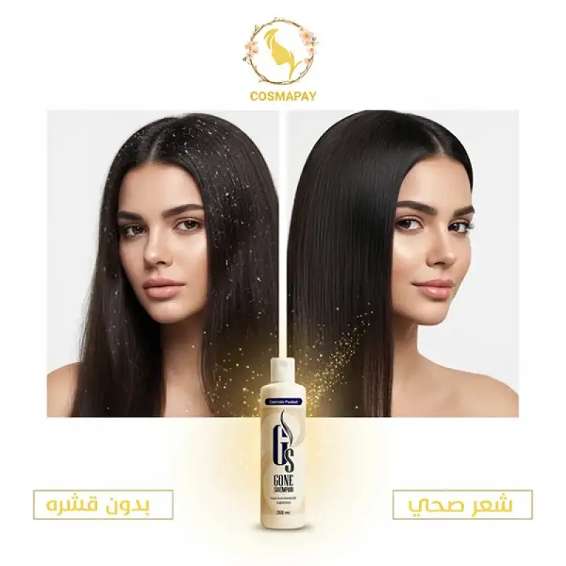 Gone Shampoo